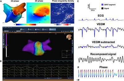 Standardizing Single-Frame Phase Singularity Identification Algorithms and Parameters in Phase Mapping During Human Atrial Fibrillation